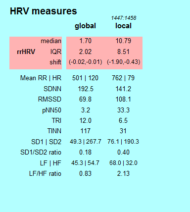 Overview of the HRV parameters.